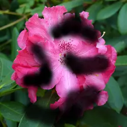 Rétinopathie diabétique